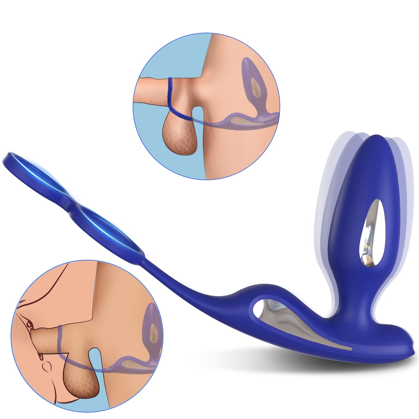 EmberIntimacy's Zenith - The E-Stim Vibrating Prostate Massager & Ring